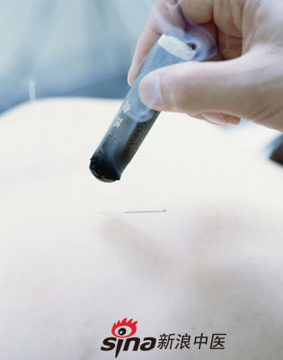 點(diǎn)擊將在新窗口查看全圖 反復咳嗽 試試中醫特色療法