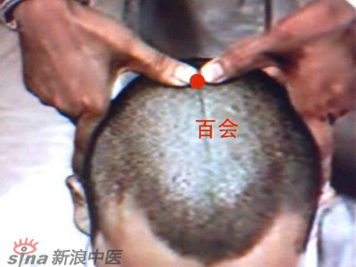 艾灸常用的保健穴有哪些？--百會(huì )