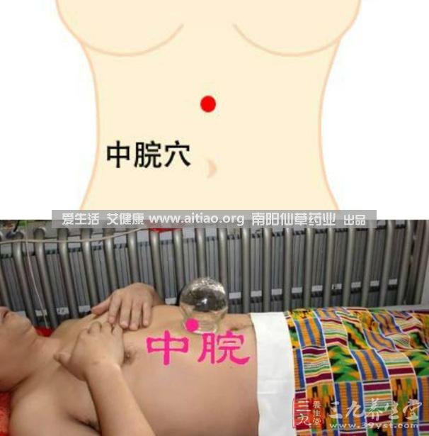 中脘穴位于腹部正中線(xiàn)，臍上4寸的位置上。每天艾灸10-15分鐘，能有效緩解胃部不適的癥狀，同時(shí)有助于祛濕。